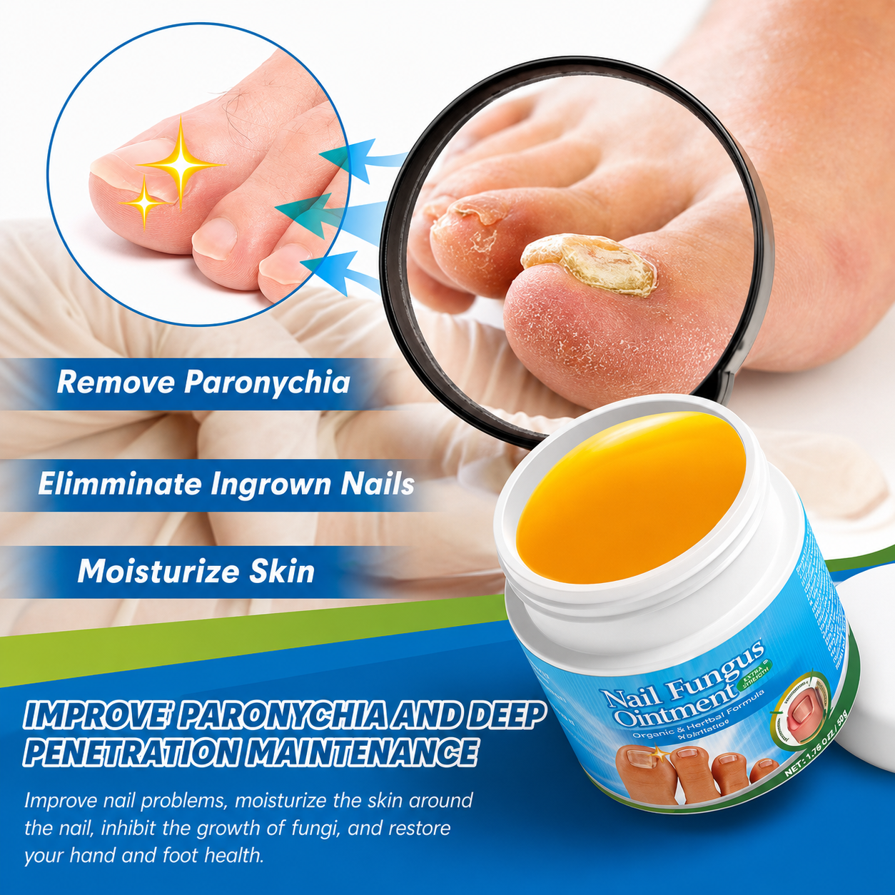 1+1 Gratis Nail Fungus Ointment PLUS – mast za negu noktiju i kože oko noktiju